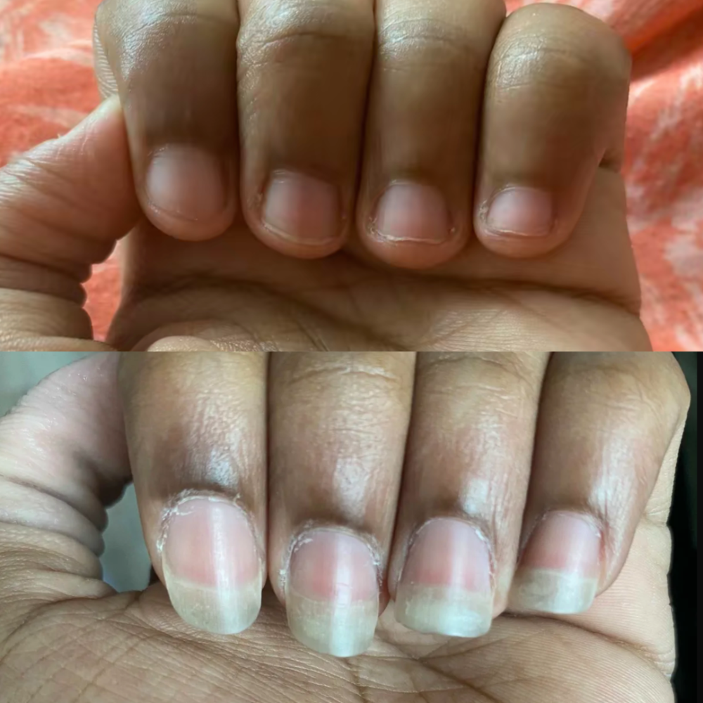 'MINI' NAIL GROWTH OIL