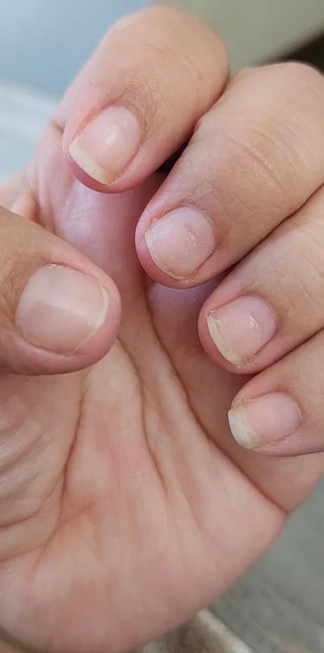 Nails before using Radiant nail growth oil: short, thin and peeling