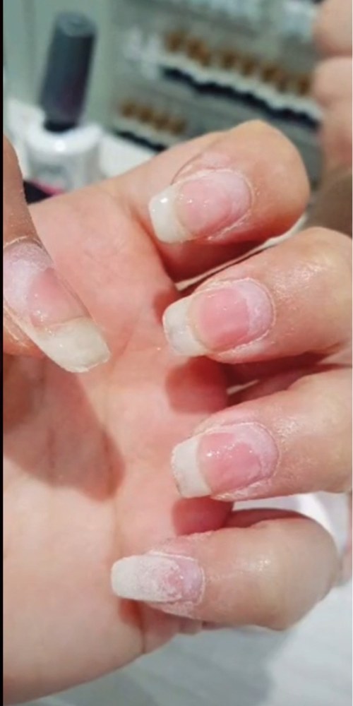 Customer 4, Nails after using Radiant nail growth oil
