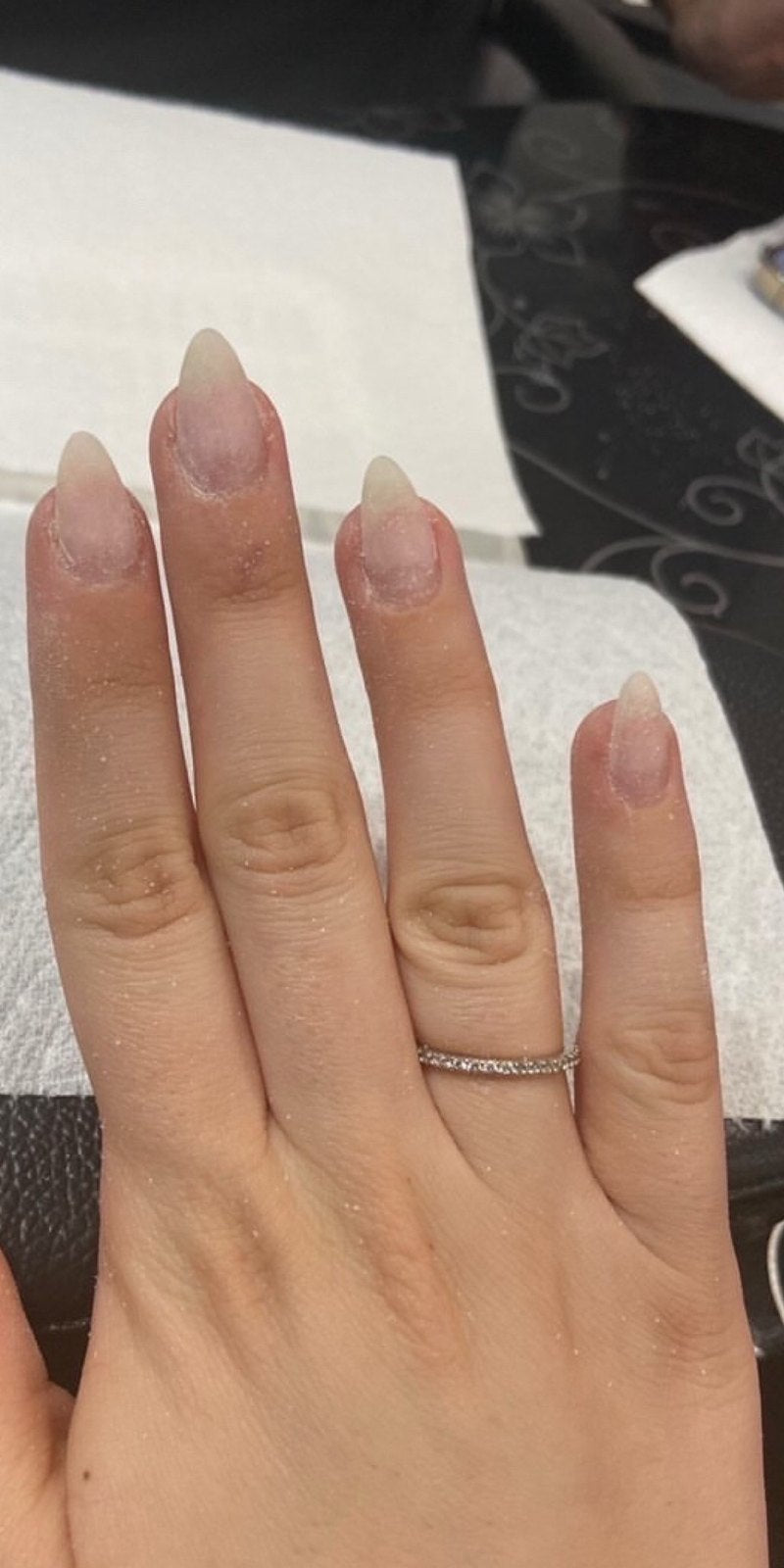 Customer 5, Nails after using Radiant nail growth oil